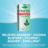 Nature’s Way Boericke & Tafel Oral Ivy Liquid, Poison Ivy & Oak Treatment**, Relieves Itching & Burning**, 1 Fl. Oz